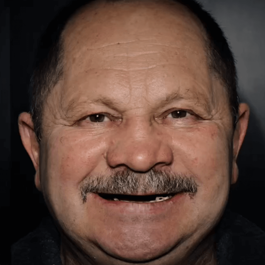До